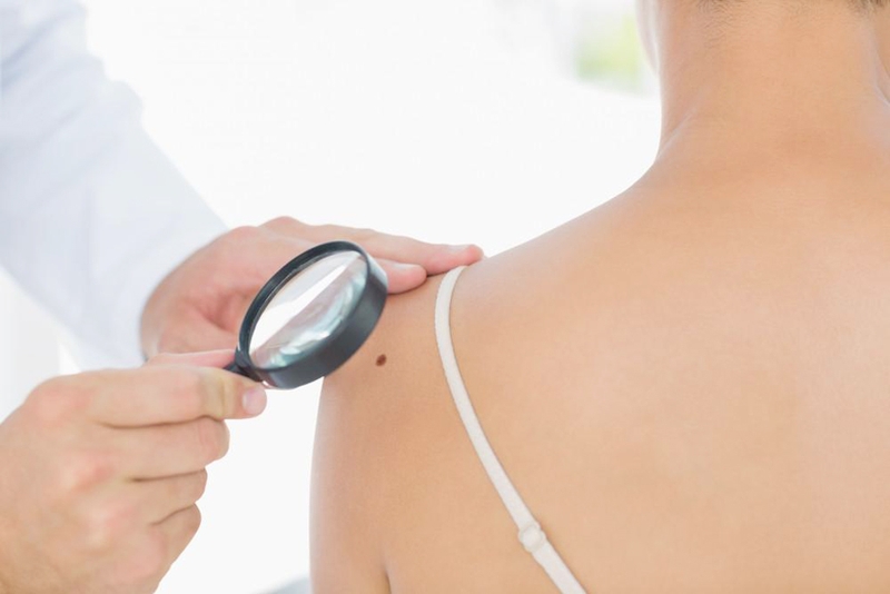 U xơ dưới da là gì? Cách phân biệt với u mỡ dưới da 3