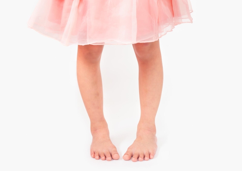 U xương sụn là gì? Dấu hiệu nhận biết, điều trị và cách phòng ngừa u xương sụn 4