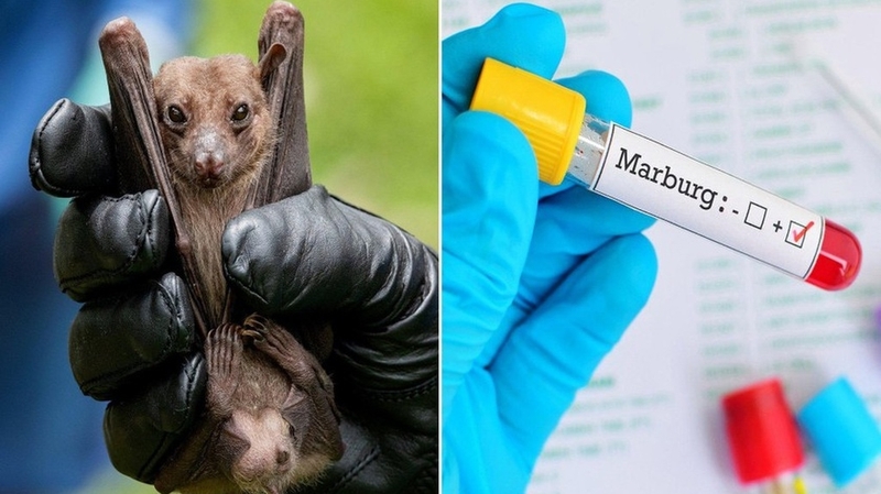 UBND TP.HCM yêu cầu tăng cường giám sát phòng, chống dịch bệnh Marburg - Hình 2