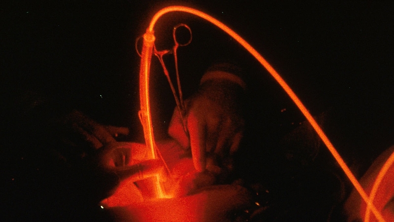 Ứng dụng liệu pháp quang động trong điều trị một số bệnh lý 2