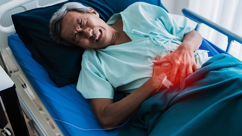 Ung thư biểu mô tế bào gan có mấy giai đoạn là thắc mắc của nhiều người