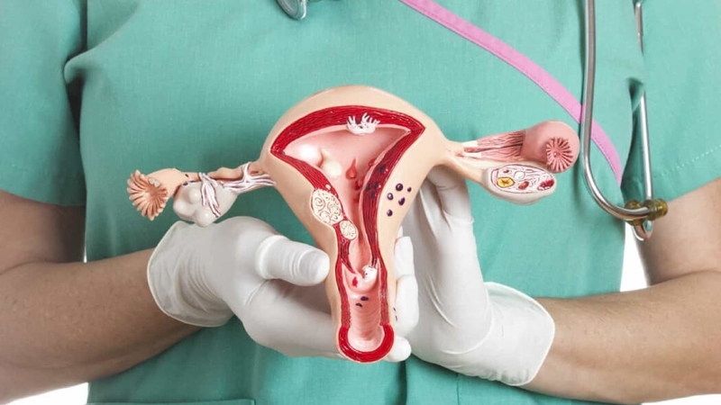 Giải đáp ung thư buồng trứng giai đoạn 1 sống được bao lâu