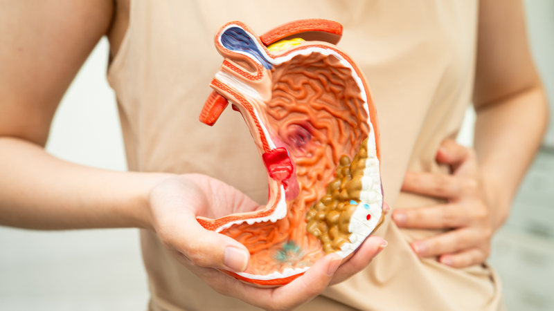 Ung thư dạ dày có nên mổ không​?