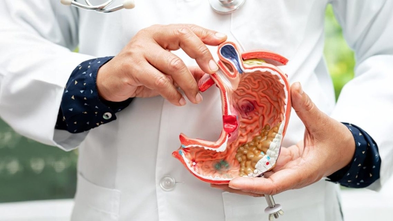 Mức độ di căn và chức năng gan có thể ảnh hưởng đến tiên lượng bệnh