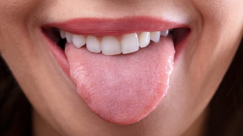 Ung thư lưỡi giai đoạn 2 có nguy hiểm không? 2