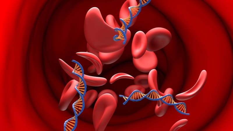 Ung thư máu có di truyền không là băn khoăn của nhiều độc giả