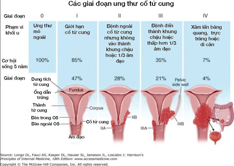 nhung-dieu-can-biet-ve-sang-loc-ung-thu-co-tu-cung-2