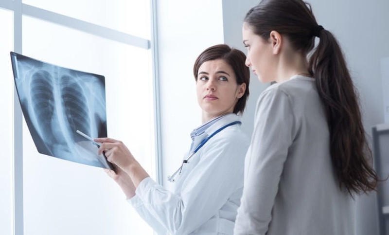 Ung thư phổi giai đoạn 2 sống được bao lâu 3