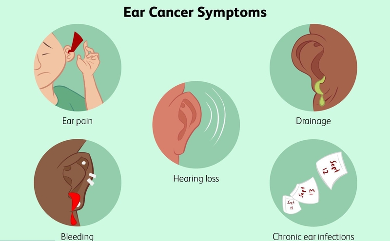 Ung thư tai có chữa được không?2