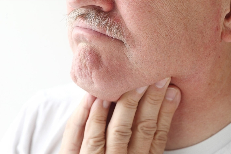 Ung thư thanh quản là gì? Người bị ung thư thanh quản sống được bao lâu? 3