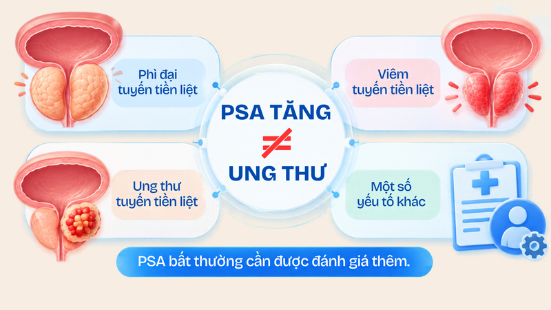 ung-thu-tuyen-tien-liet-phat-hien-som-co-phai-dieu-tri-ngay-2.png