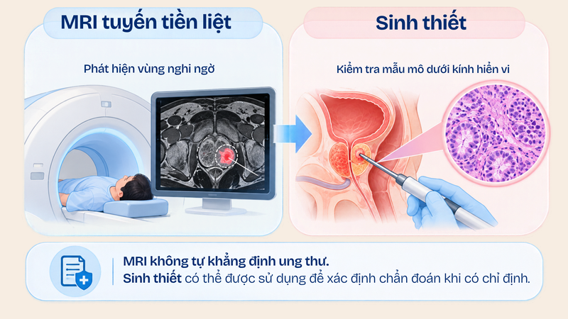 ung-thu-tuyen-tien-liet-phat-hien-som-co-phai-dieu-tri-ngay-3.png