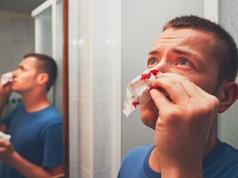 Ung thư vòm mũi là bệnh gì? Nguyên nhân, triệu chứng và cách phòng ngừa 7