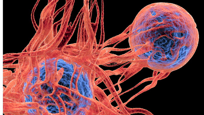 Ung thư di căn cơ quan nội tạng khác