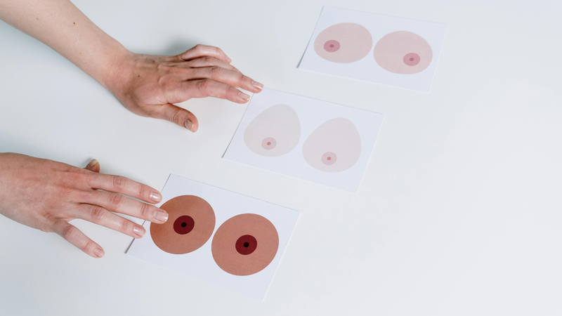 Những bất thường trên bề mặt da vú và núm vú