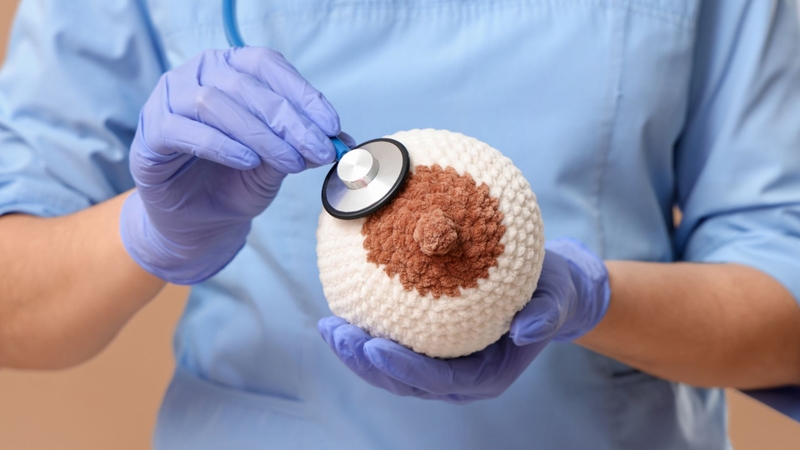 Ung thư vú Luminal B có tốc độ tăng sinh tế bào cao hơn Luminal A