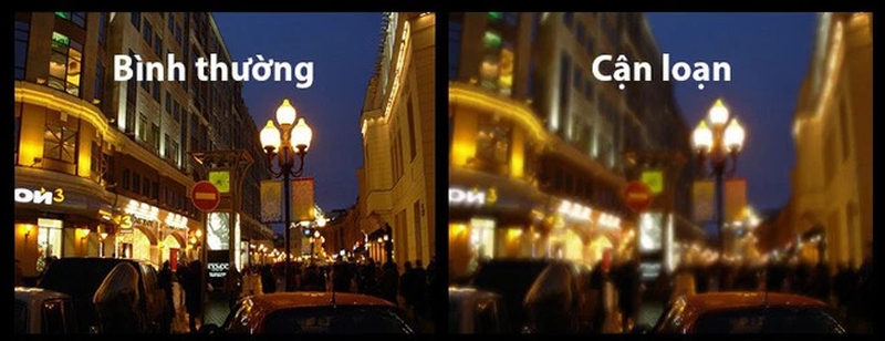 Vừa cận thị vừa loạn thị chữa như thế nào? 1