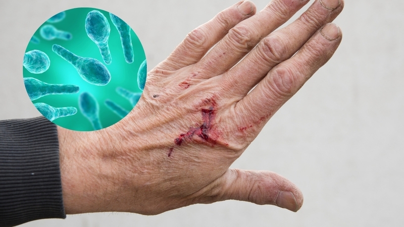 Giải đáp chi tiết thắc mắc uốn ván nguy hiểm như thế nào