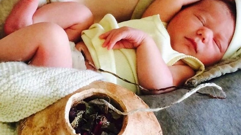 Uốn ván rốn trẻ sơ sinh: Dấu hiệu triệu chứng của bệnh