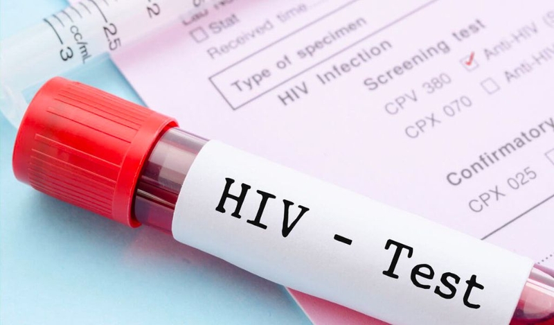 Uống ARV bao lâu thì xét nghiệm âm tính? 3