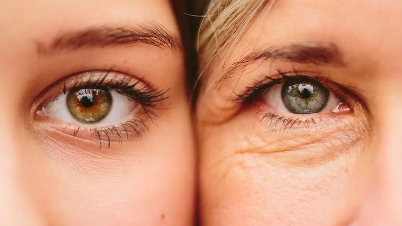 Uống collagen có tác dụng phụ không? Những điều cần lưu ý 3