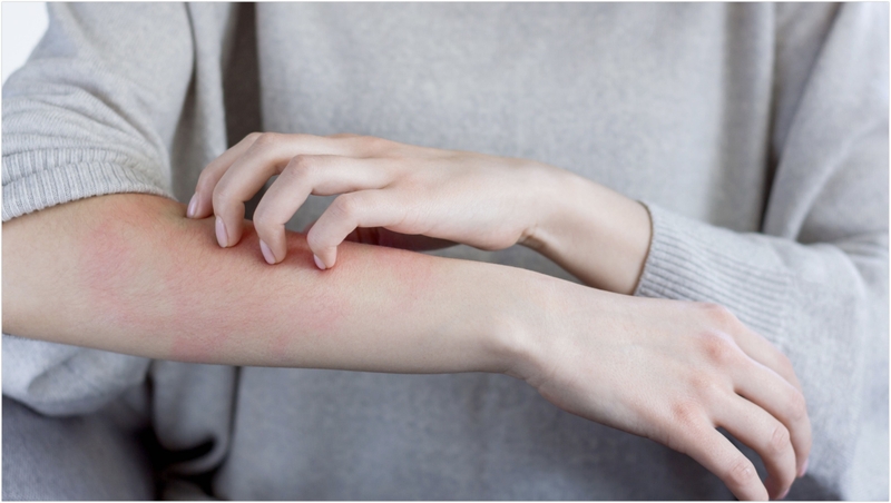 Uống dầu dừa mỗi ngày có tốt không? 5