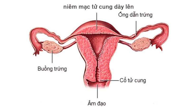 Uống Duphaston ra dịch nâu? Tìm hiểu nguyên nhân và giải đáp thắc mắc 3