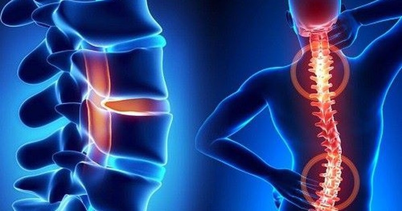 Uống Glucosamine với canxi được không? Cần lưu ý những gì khi sử dụng?1