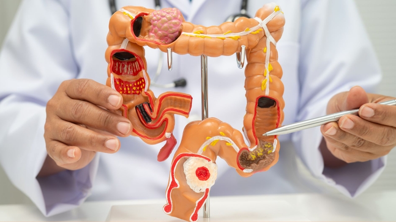 Men tiêu hóa hỗ trợ quá trình tiêu hóa diễn ra thuận lợi hơn