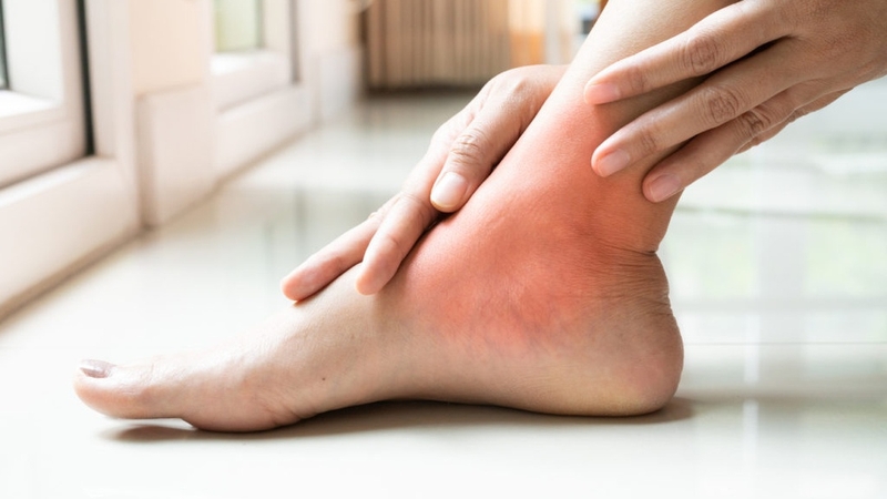 Uống nhiều allopurinol có tốt không? Cần lưu ý gì khi sử dụng? 2