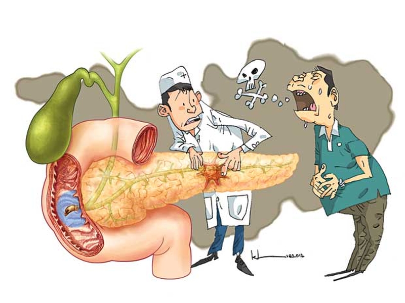 Uống nhiều rượu bia gây viêm tụy cấp 3