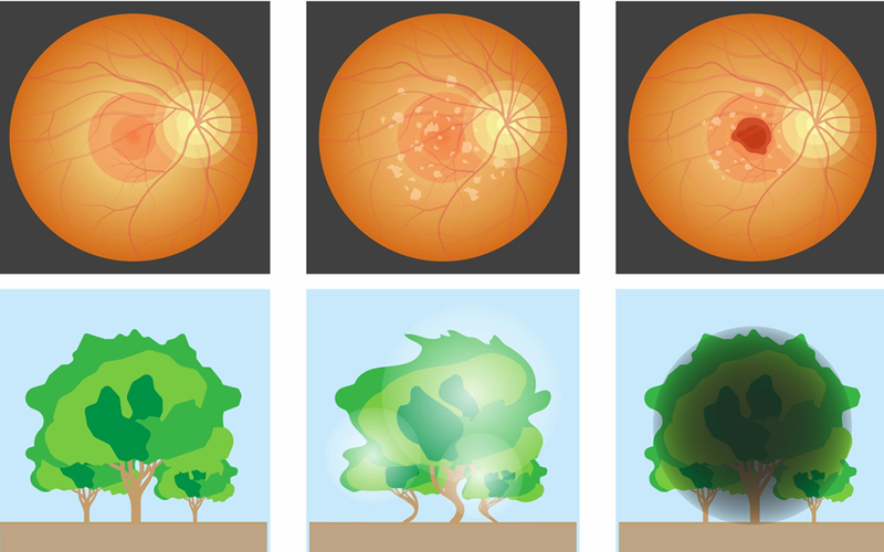 Hỏi đáp: Uống rượu nhiều có ảnh hưởng đến mắt không? 2