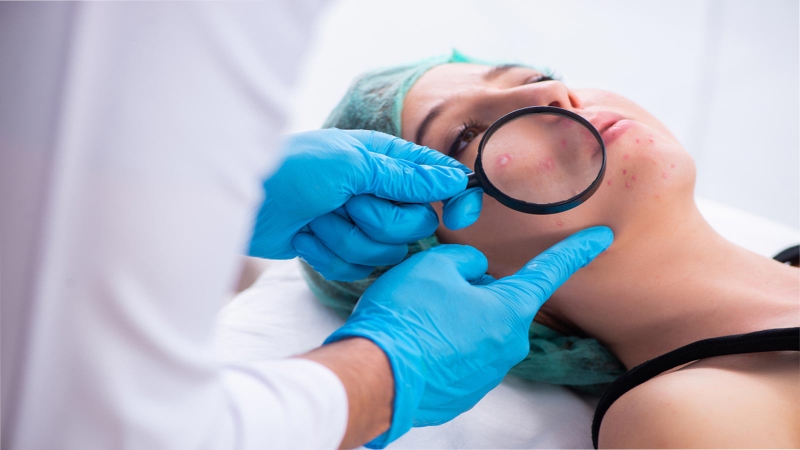 Uống thải độc gan có hết mụn không? 3