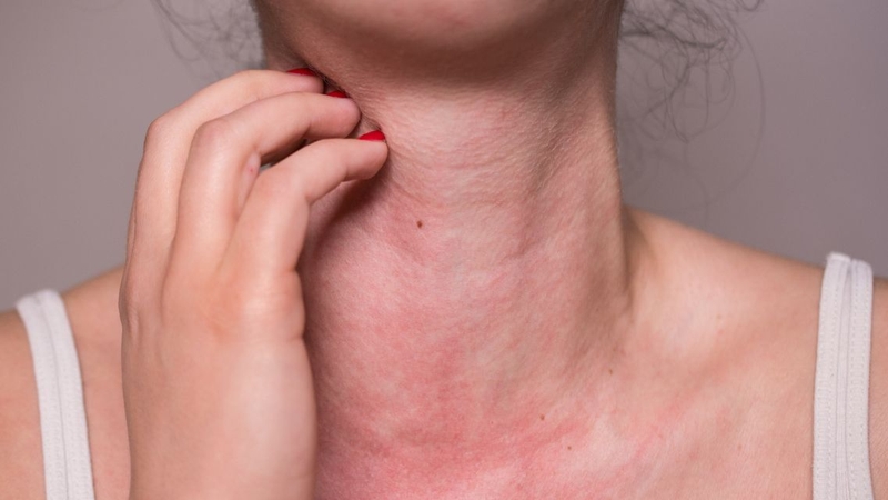 Lạm dụng thuốc hoặc dùng kéo dài có thể làm tăng nguy cơ tác dụng phụ