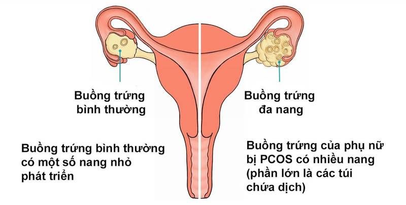 Uống thuốc Duphaston bao lâu thì có kinh: Hướng dẫn và lời khuyên khi dùng Duphaston 1