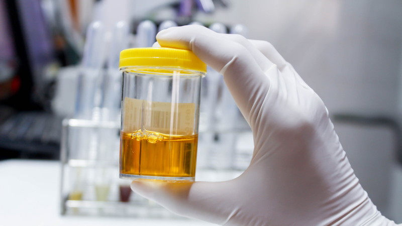 uong-thuoc-giai-doc-gan-nuoc-tieu-mau-vang-la-vi-sao 2