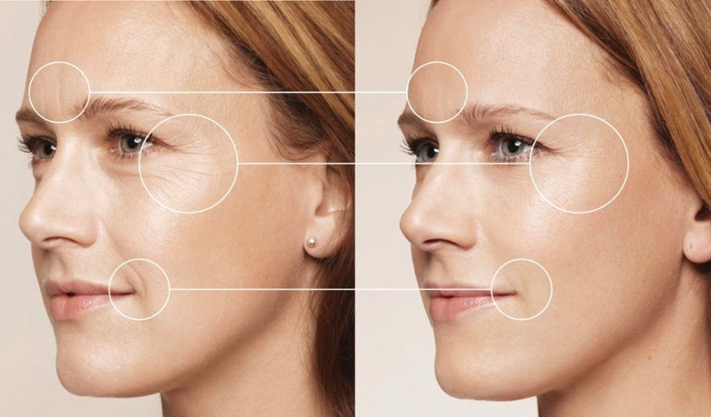 Uống vitamin gì để trị tàn nhang? Lưu ý khi sử dụng viên uống vitamin 2