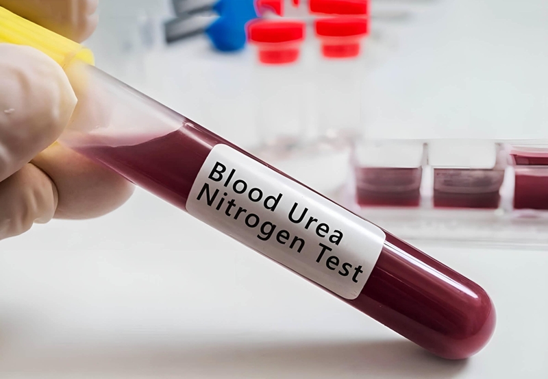 Ure là chất gì? Vai trò của phương pháp xét nghiệm ure máu 2