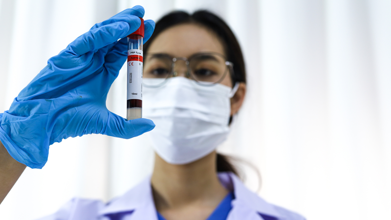 Hiểu rõ ure trong xét nghiệm máu là gì giúp bạn nhận thức đúng vai trò của chỉ số này