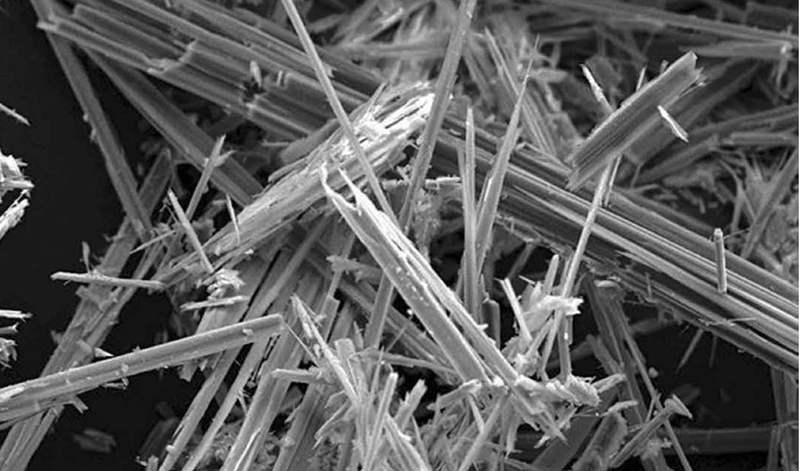 U trung biểu mô là gì? 5