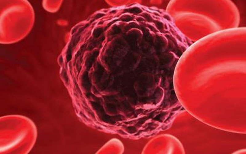 Nội soi tai mũi họng ống mềm giúp phát hiện ung thư