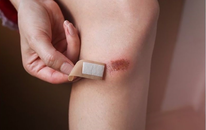 Ưu và nhược điểm của băng keo cá nhân mà bạn nên biết 4