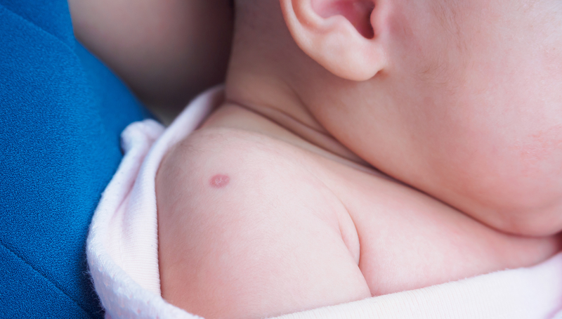 Vắc xin 5 trong 1 có từ năm nào? Những lưu ý cần biết khi chích ngừa vắc xin 5 trong 1 3