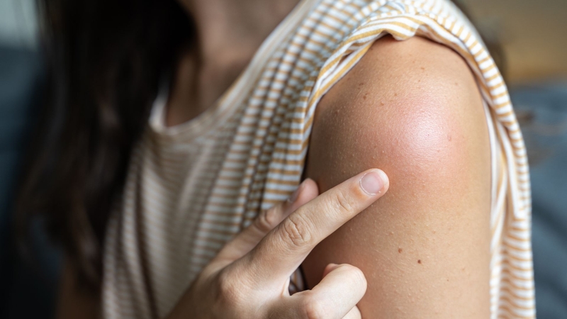 Vắc xin PREVENAR 13 (Bỉ)