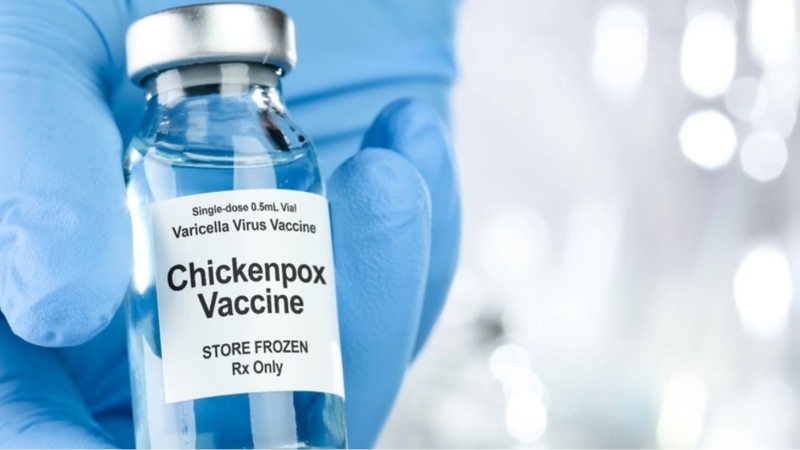 Vắc xin thủy đậu có mấy loại?