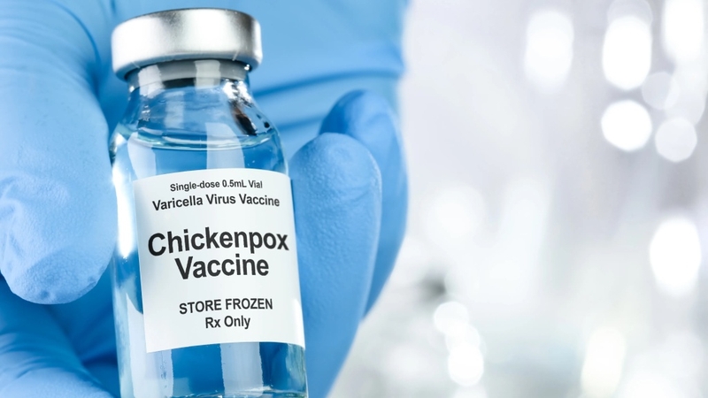 Vắc xin thủy đậu có mấy loại? Những điều cần lưu ý khi tiêm 2