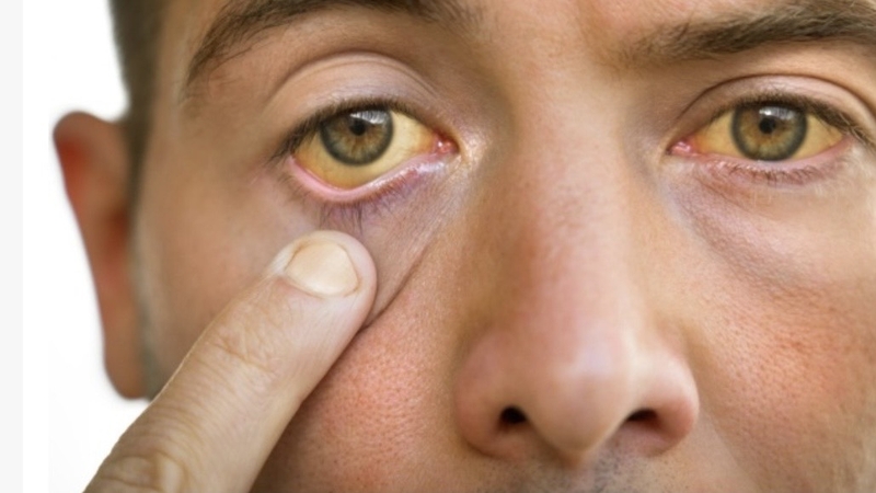 vaccine-giai-doc-to-la-gi-uu-diem-cua-vaccine-giai-doc-to-so-voi-vaccine-khac 4