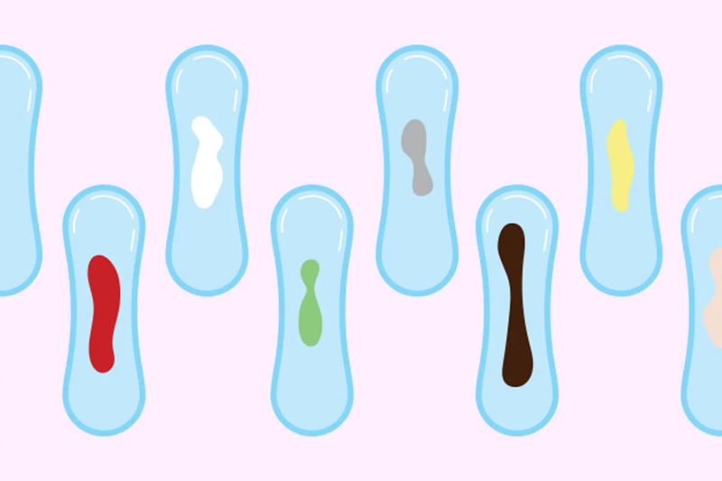 Vaginal discharge là gì? Vaginal discharge như thế nào là bình thường?3