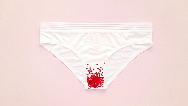 Vaginitis là gì? Tìm hiểu về căn bệnh phái nữ thường gặp 4