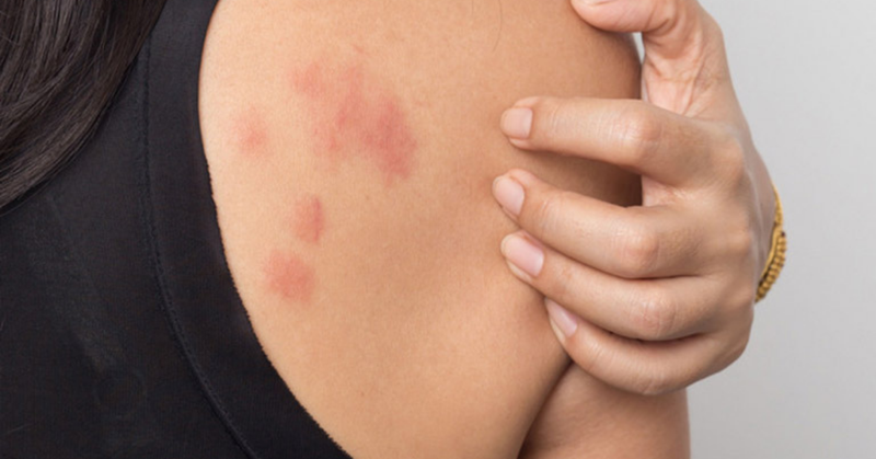 vải bao nhiêu calo 4